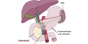 Abb 3a