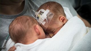 BILD: Beim "Kangarooing" kuscheln Eltern oft stundenlange mit ihren Kindern, die noch auf unserer Neonatologie betreut werden. 